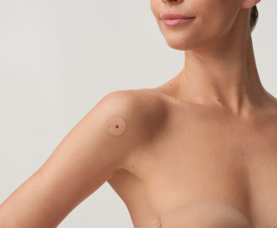 CHECK YOUR SKIN, SAVE YOUR LIFE.